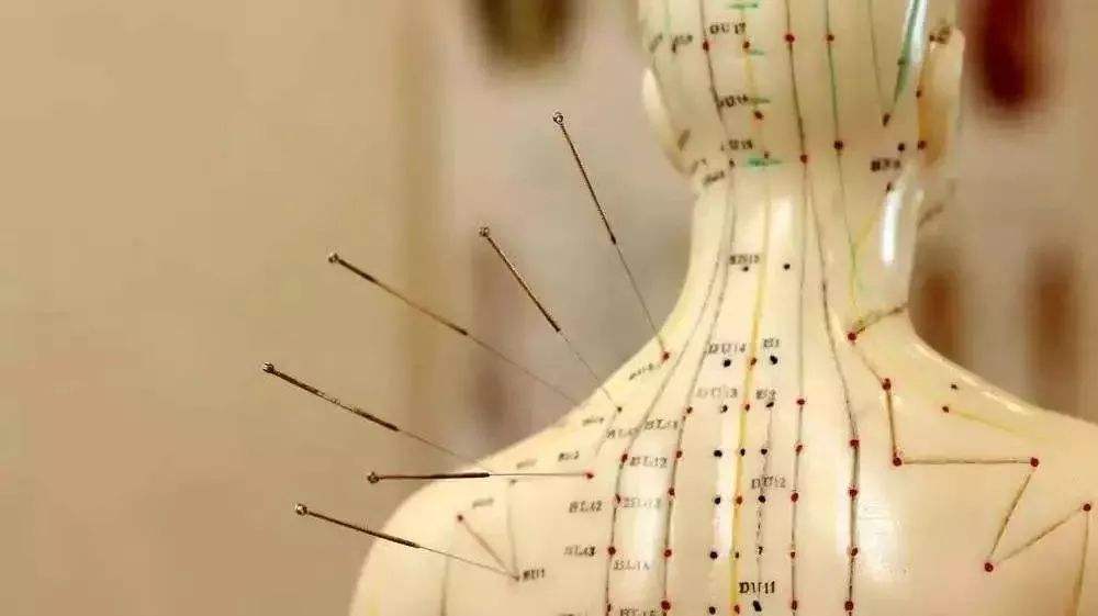 Massage eller akupunktur søvnbehandling Frederiksberg