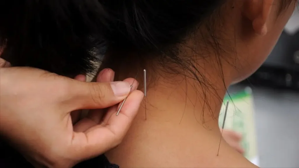 hvordan akupunktur og massageterapi kan lindre nakkesmerter