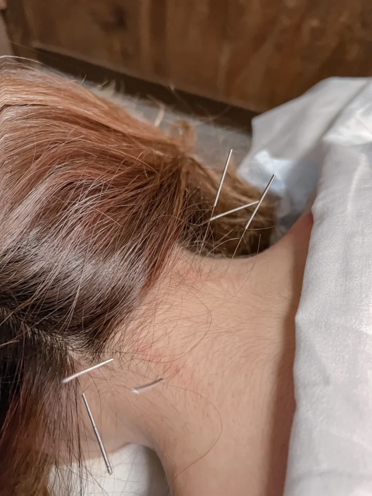 hvordan man lindrer nakkesmerter forårsaget af langvarig siddende arbejde