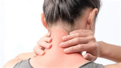 Refunderet akupunkturbehandling via sundhedsforsikring