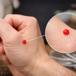 person med smerter i nakke skulder og lænd ryg symptomer behandlet med akupunktur i Frederiksberg