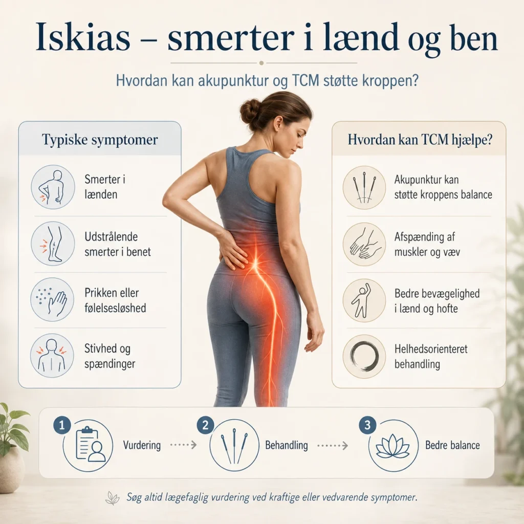 Infografik om iskias, lændesmerter og akupunkturbehandling